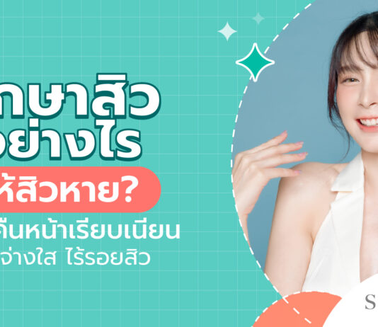 รักษาสิว