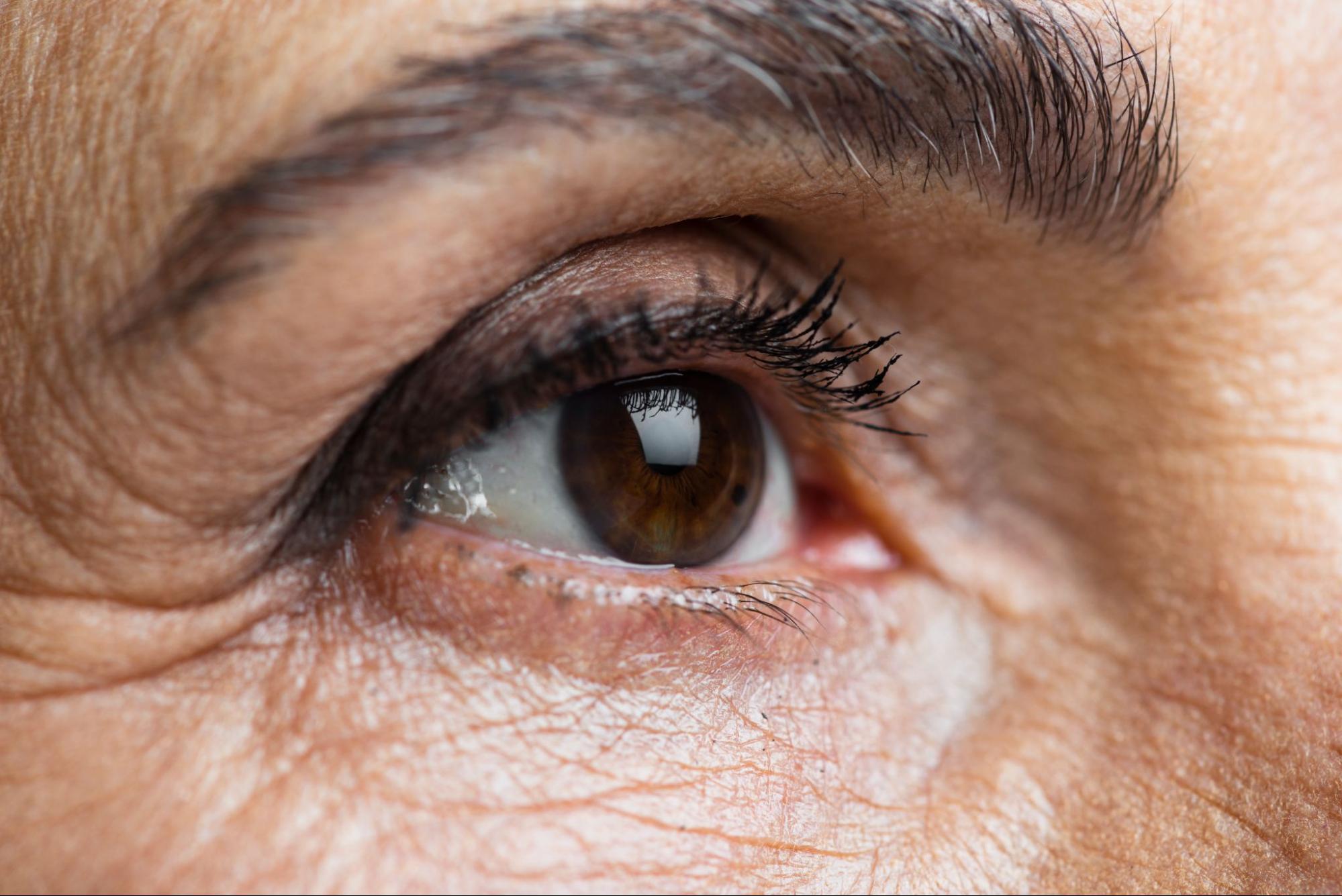cataracts causes and risk